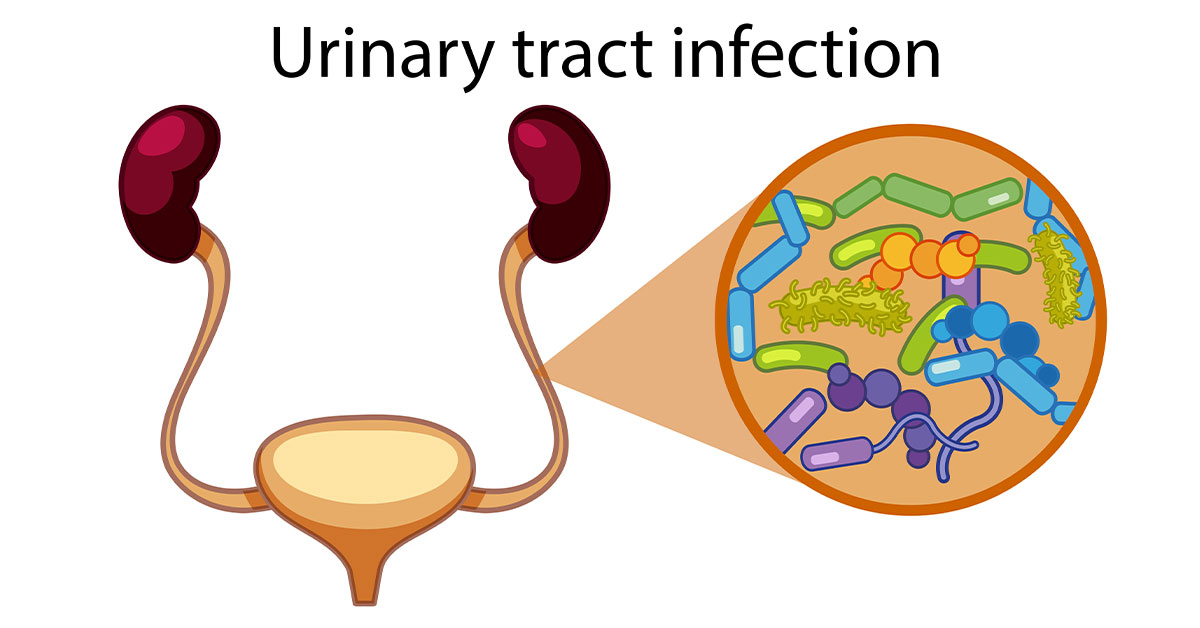 Causes and Treatments of Urinary Tract Infection