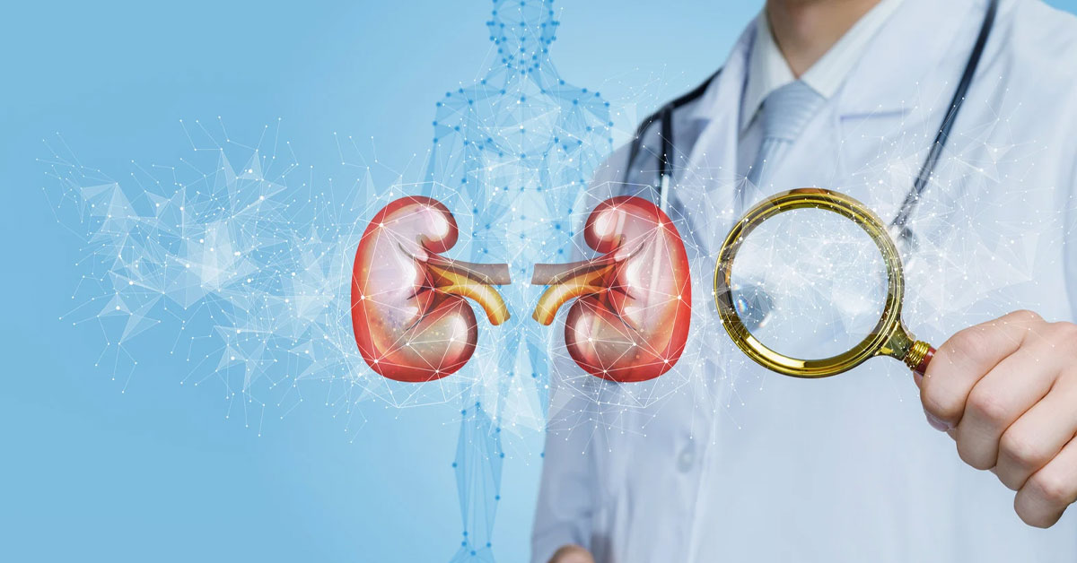 kidney doctor in Siliguri